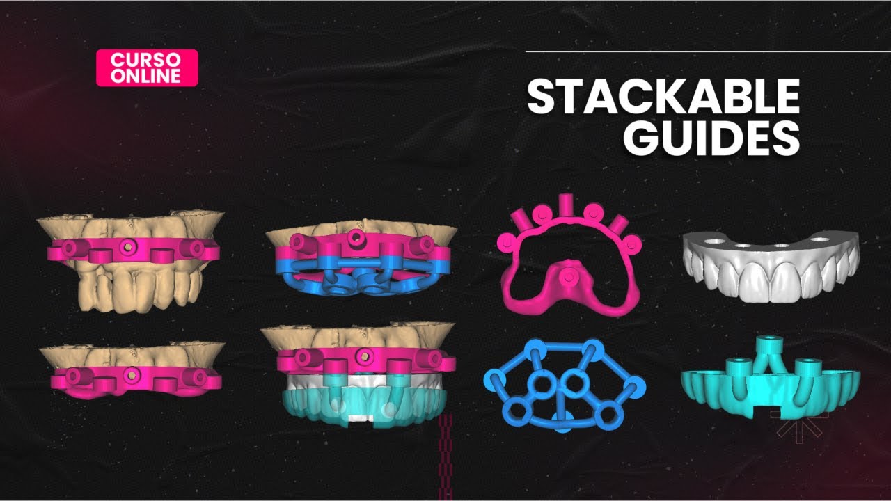 STACKABLE GUIDE - AULA ABERTA - YouTube