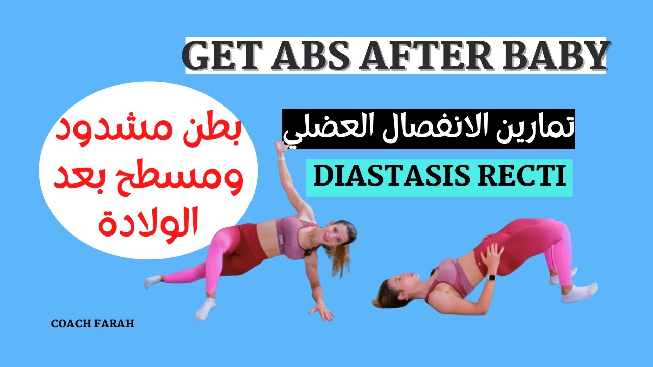 GET ABS AFTER BABY | DIASTASIS RECTI EXERCISES | شد ترهلات البطن بعد الولادة  تمارين الانفصال العضلي