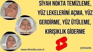 Siyah Nokta Temizleme, Yüz Lekelerini Açma, Yüz Gerdirme, Yüz Ütüleme, Kırışıklık Giderme