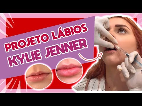 Vídeo: Anastasia no aumento labial com preenchimento