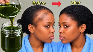 Just 1 INGREDIENT 😱 Apply it on your Hair for just 3 DAYS and your Hair will grow 3 Times FASTER!