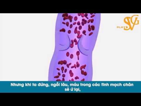 Video Những biểu hiện bệnh giãn Tĩnh mạch - youtube