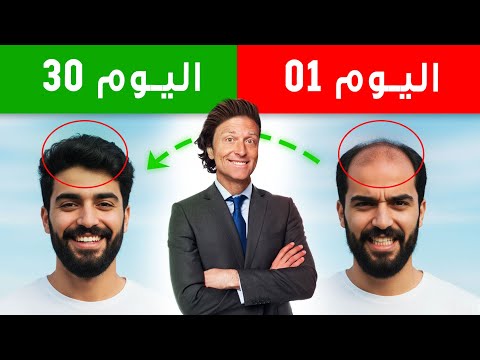 انتهى زمن الصلع الحل النهائي لتساقط الشعر والصلع الوراثي