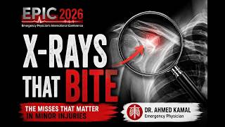 EPIC26: X-rays that bite. The Misses That Matter In Minor Injuries (Dr. Ahmed Kamal) screenshot 5