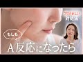 【A反応】正しい対処法と救世主。「治らない&不安な人に」【エンビロンにも】