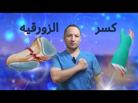 كسر العظمة الزورقيه في اليد