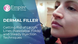 Getting Rid of Laugh Lines Nasolabial Folds and Steady Injection Techniques   DERMAL FILLER