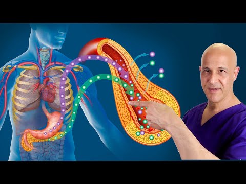 1 Fatty Acid...Reduce Insulin Resistance, Inflammation & Clogged Arteries!  Dr. Mandell