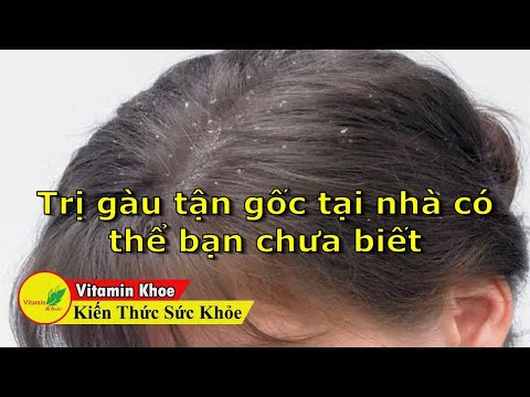 Trị gàu tận gốc tại nhà có thể bạn chưa biết