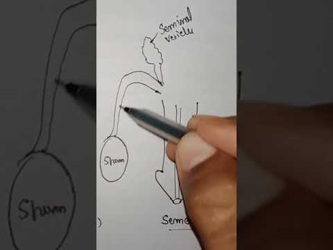 seminal vesicles location