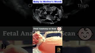 Fetal Anatomy on Scan #shorts #fetus #pregnancy Fetal Anatomy on Scan #shorts #fetus #pregnancy