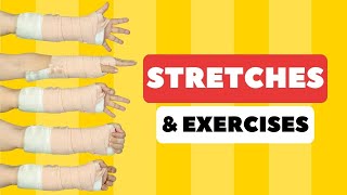 Tight Fingers & Hand After Cast Broken Wrist Stretches & Exercises