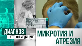 Страна глухих: как живут люди с нарушением слуха в Казахстане | Диагноз