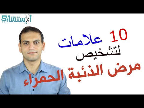 هل عندك مرض الذئبة الأعراض كاملة الاستشاري