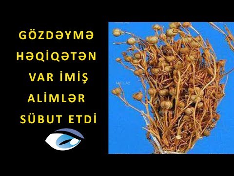 Video: Pis Göz Və Zərər əlamətləri Nədir