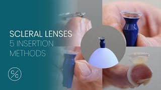 5 Insertion Methods for Scleral Lenses | Contacts with Conway