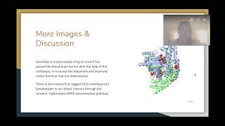 Interactive Case Study #3 Carbidopa - Google Slides