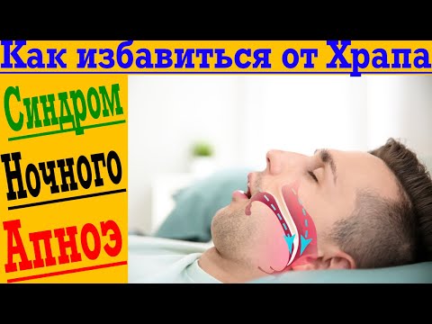 Как Избавиться от