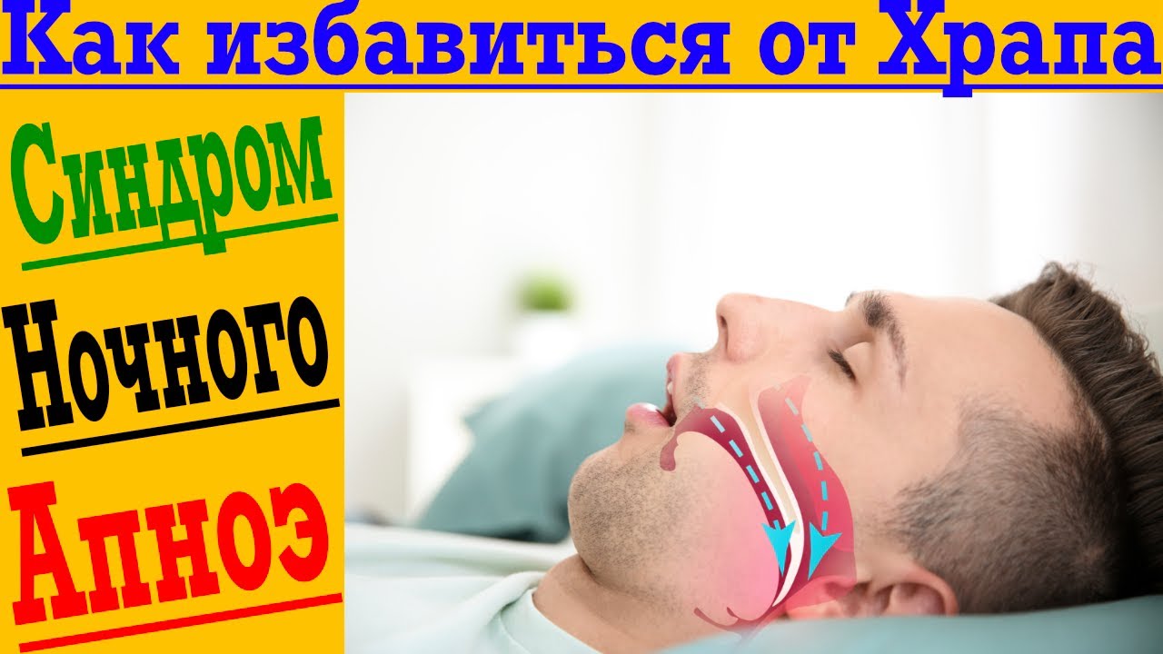 Как Избавиться от ХРАПА! Синдром Ночного Апноэ! - YouTube