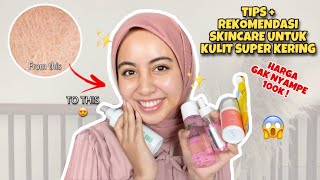 SKINCARE UNTUK ATASI KULIT SUPER KERING! dibawah 100k !