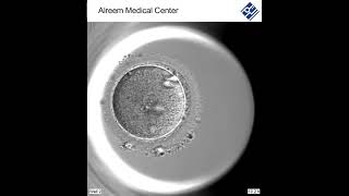 Embryo development - مراحل تطور الجنين