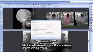 Export 2D images from Planmeca Romexis®