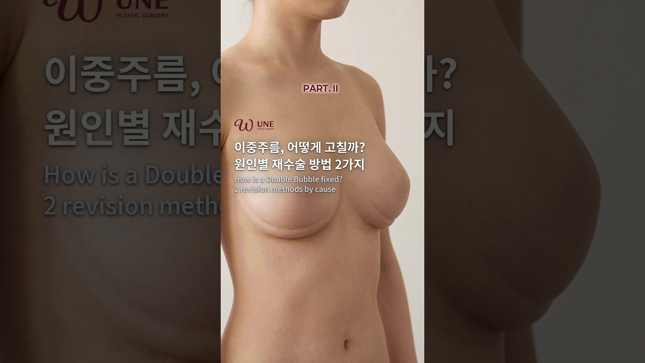 이중주름, 어떻게 고칠까? 원인별 재수술 방법 2가지 | PART. II #Shorts