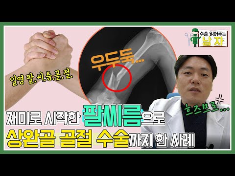 재미로 팔씨름하다가 우두둑..!!｜팔씨름 골절(상완골 골절)｜수술 읽어주는 남자