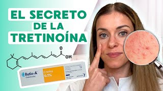 Tretinoína sin riesgos: Consejos prácticos