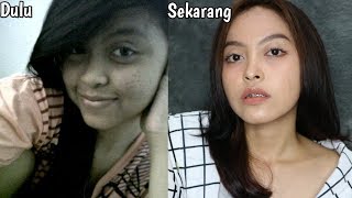 Cara mencerahkan badan secara alami | My bodycare Shinzui