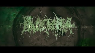 Placenta Powerfist - Cerebral Phage