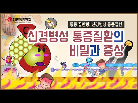 &rsquo;신경병성 통증질환&rsquo;이 생기는 과정 (3편부터 보세요~) | 신경병성 통증질환 4