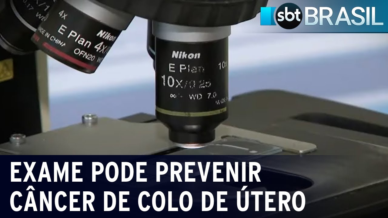 Exame de HPV baseado no DNA pode prevenir câncer de colo de útero | SBT Brasil (02/07/22)