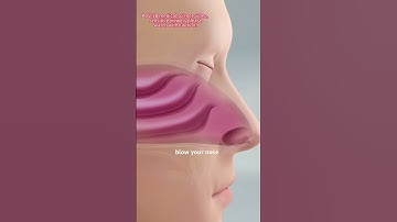 Sinus Rinse Procedure 3D Animation #music #motivation #epic #like #subscribe