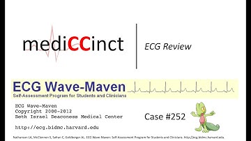 Atrial Flutter/Fibrillation with RVR (ECG Wave-Maven) Case #252