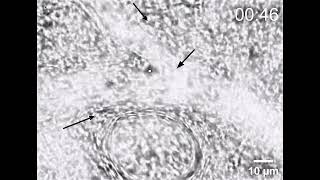 Noninvasive interception of circulating leukocyte in vivo by optical tweezer array - Supp. Video 4