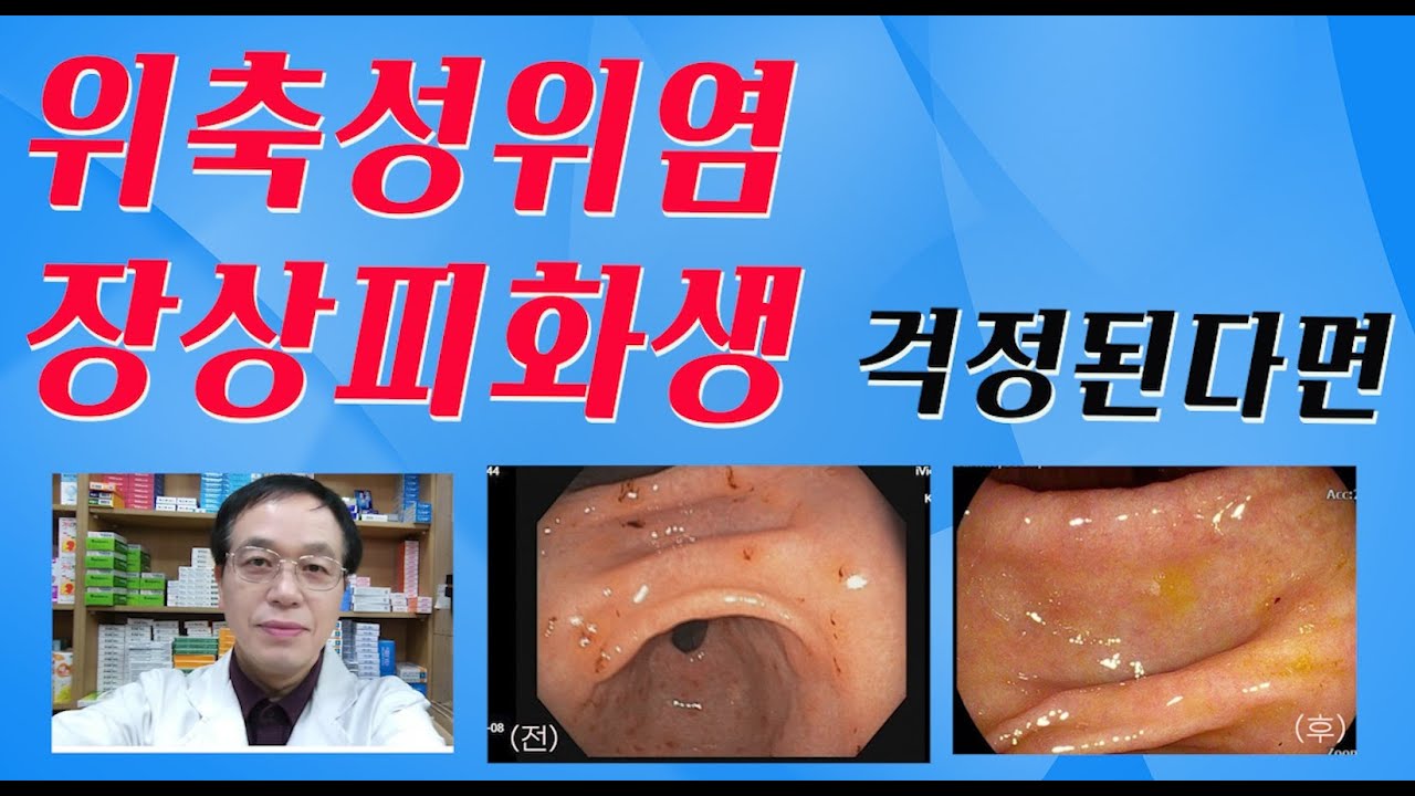 위축성위염 장상피화생 걱정된다면 - YouTube