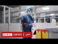 من داخل قسم الإنعاش كيف يخوض الطاقم الصحي معركته ضد فيروس كورونا 