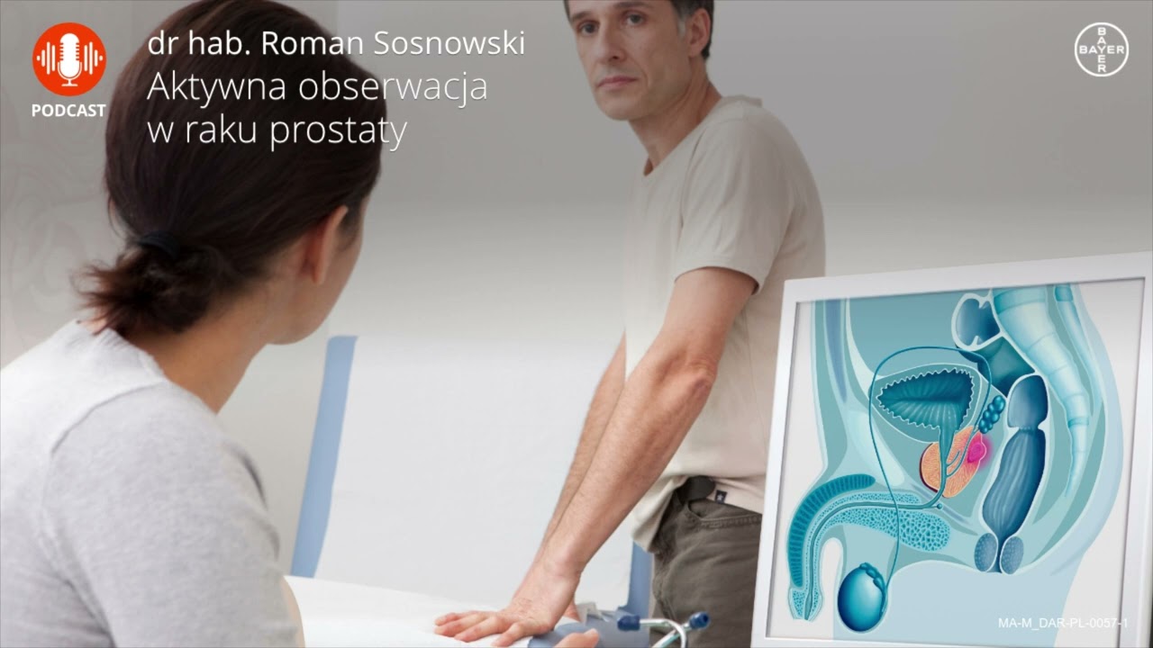 Aktywna obserwacja w raku prostaty