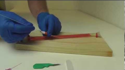 How to save a life with a 20G IV