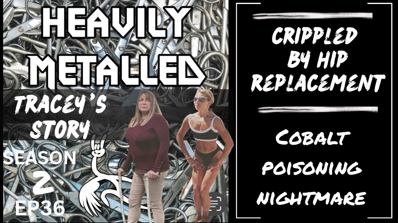 EP 36 - Crippled By Hip Replacement - Cobalt Poisoning Nightmare - Tracey's Story