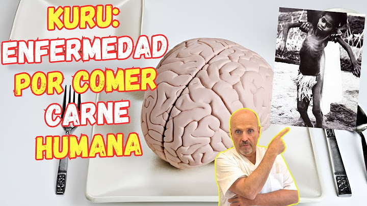 🚨 KURU LA ENFERMEDAD QUE DA POR COMER CARNE HUMANA 🚨 CAUSAS, SÍNTOMAS Y TRATAMIENTO