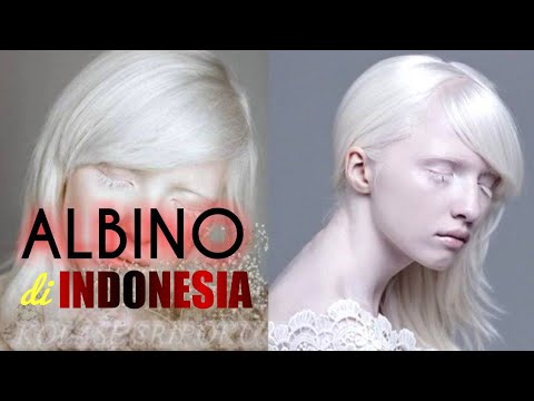 ALBINO di INDONESIA - YouTube