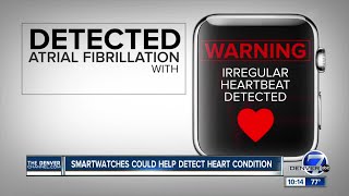 Study Apple Watch May Help Doctors Spot Heart Condition