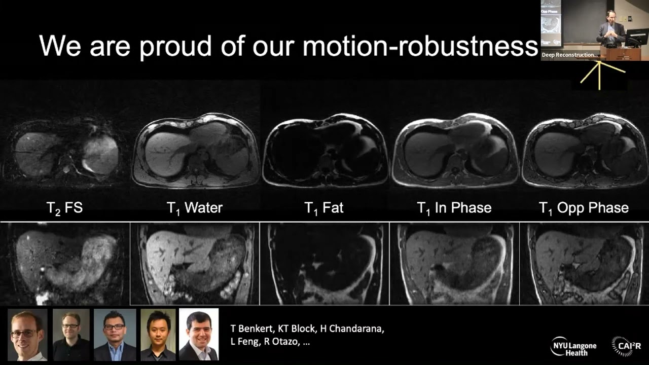 Lessons from the Deep Biology of Seeing