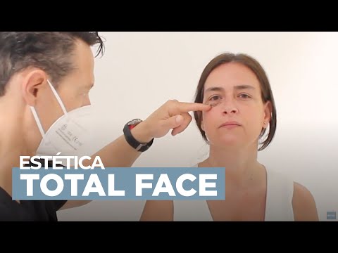 Full Face · Total Face · Bótox y Ácido Hialurónico