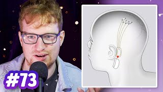 Neuralink: Elon Musk's Brain Chip | Sci Guys Podcast #73