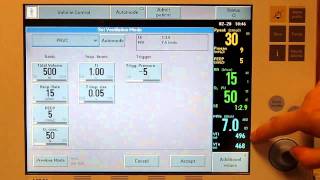 Prvc Start Up And Manditory Breaths