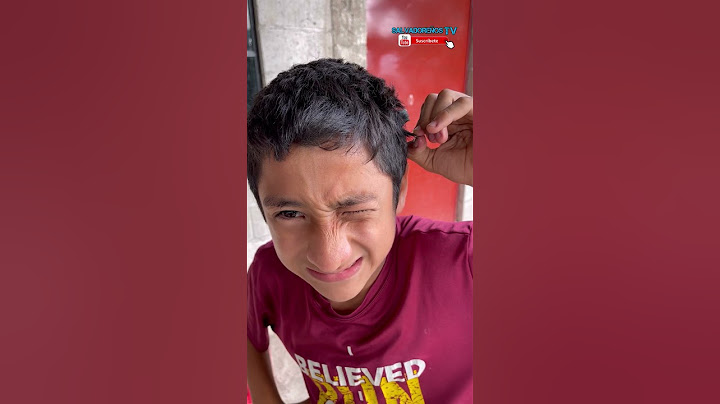 me PEGARON CHICLE en el pelo #shorts #youtubeshorts #short