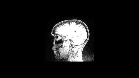 fMRI Structural Scan -animated